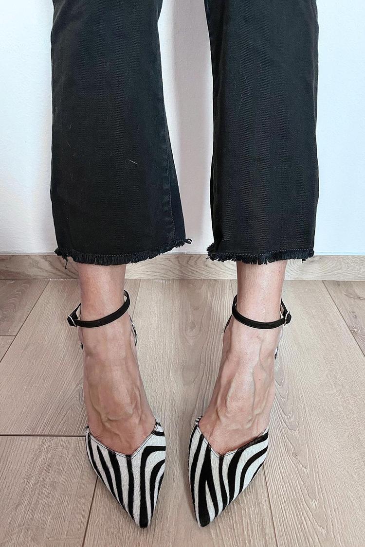 Sophia | Zebra Print Pumps with Ankle Strap
